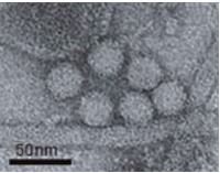 病毒研究 | 日立電鏡帶你直面諾如、甲流病毒